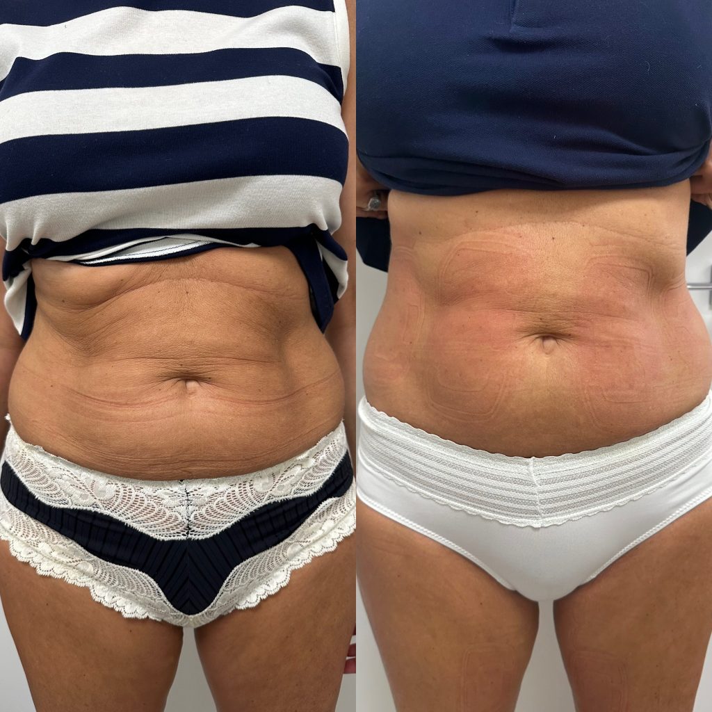 D8E90248-CB49-4CD8-B6AC-241FD26D21A6